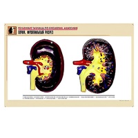Рельефная таблица "Почка. Фронтальный разрез" (формат А1, матовое ламинир.) - «globural.ru» - Якутск